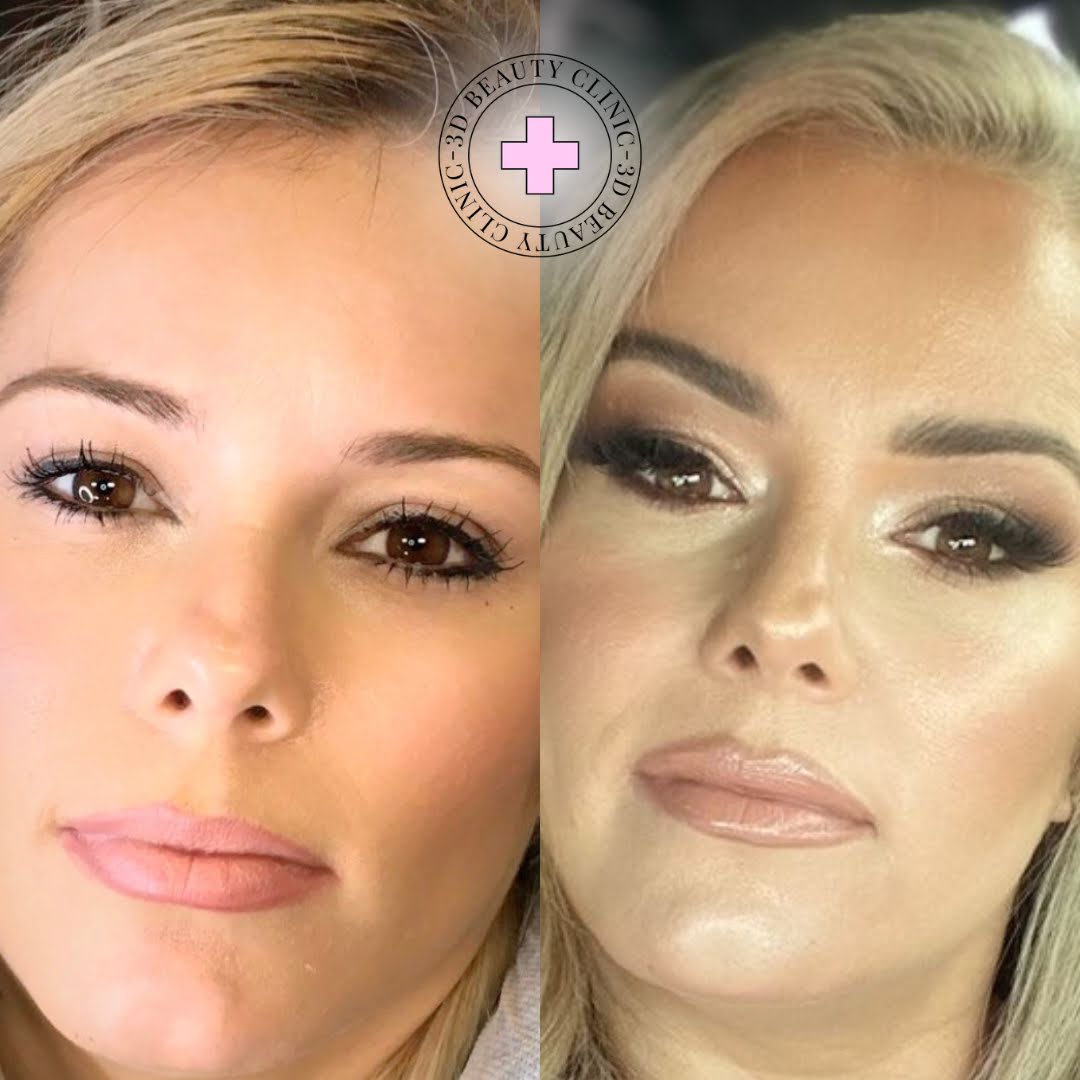 3D Beauty Clinic, piercing studio in Orange, CA