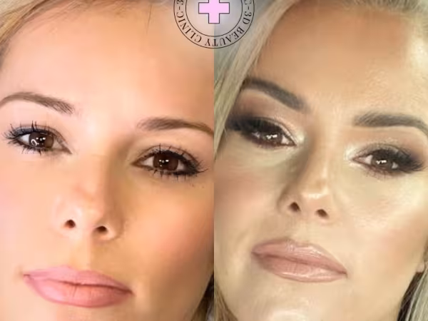 3D Beauty Clinic, piercing studio in Orange, CA